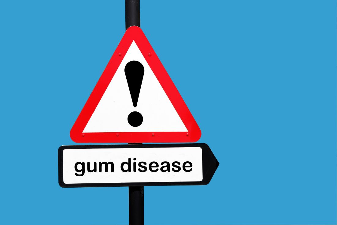 Gum Disease Signs Philadelphia PA